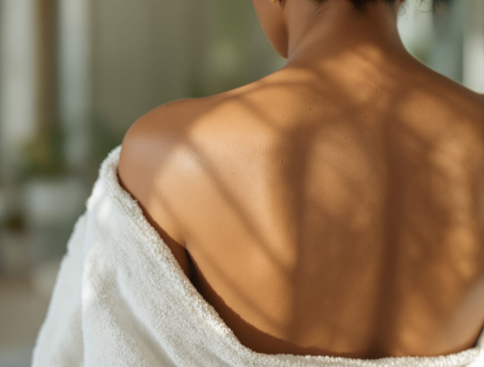Upper back of a woman in soft window light, the trunk area where progressive macular hypomelanosis patches usually appear.